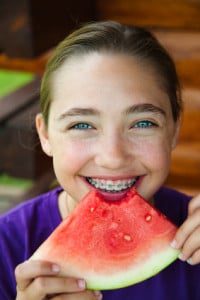 , Brace yourself for SUMMER!, Cooper &amp; Misner Orthodontics