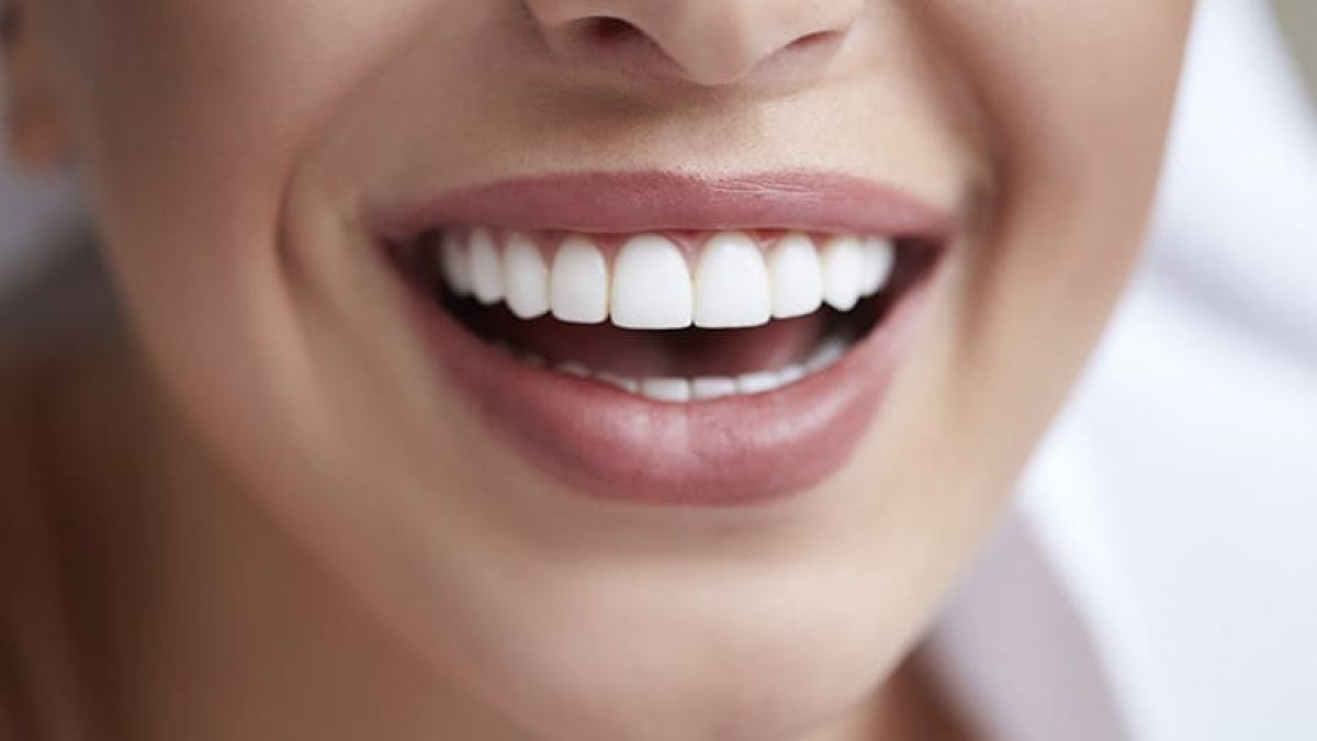 Limited Orthodontic Treatment