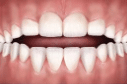 open bite teeth