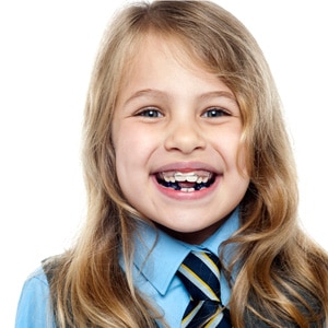 little girl smiling with braces