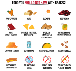 foods to avoid with braces, Foods You Should Avoid With Braces (&#038; Foods We Recommend), Cooper &amp; Misner Orthodontics