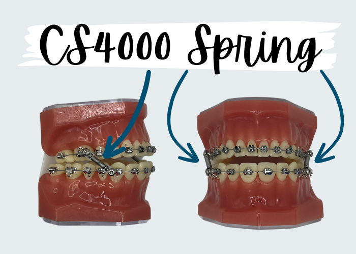 spring, What is a CS4000 Spring?, Cooper &amp; Misner Orthodontics