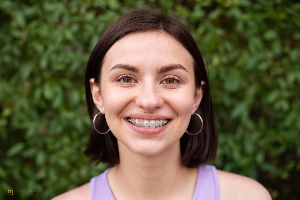 Young woman smiling confidently after orthodontic treatment—results from learning how to fix overbite in Tulsa, OK early.