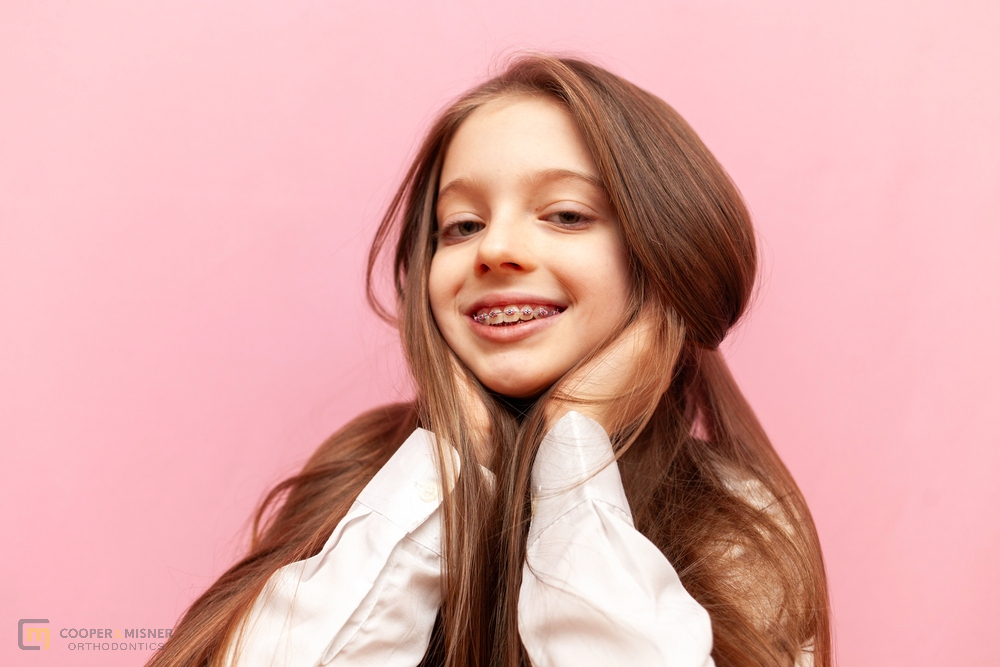 Braces for Overbite in Tulsa, Braces for Overbite in Tulsa, OK, Cooper &amp; Misner Orthodontics