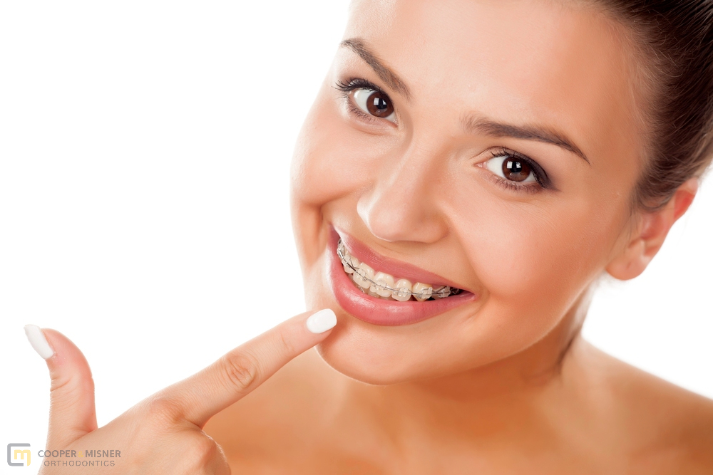 smiling woman with clear braces - Clear Braces vs Metal Braces in Tulsa, OK