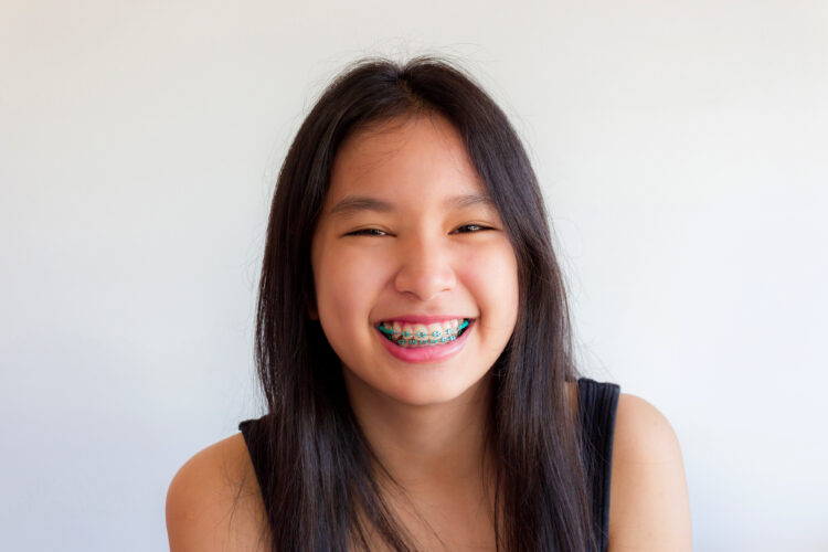 how much do braces cost in Tulsa